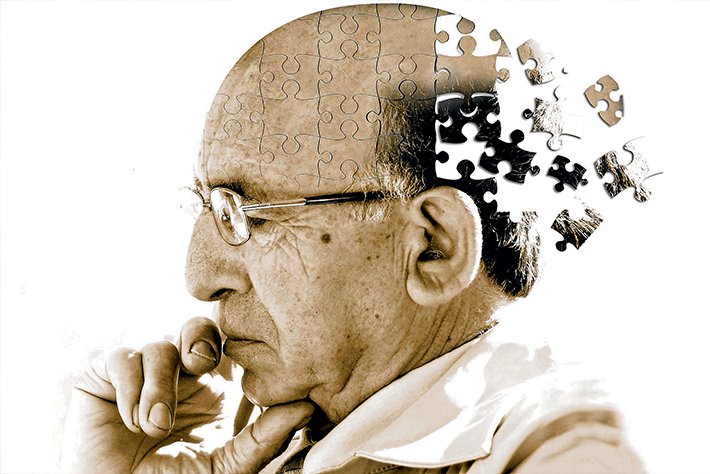 primeros síntomas del alzheimer