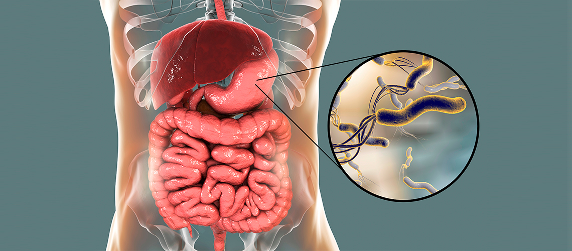 helicobacter pylori