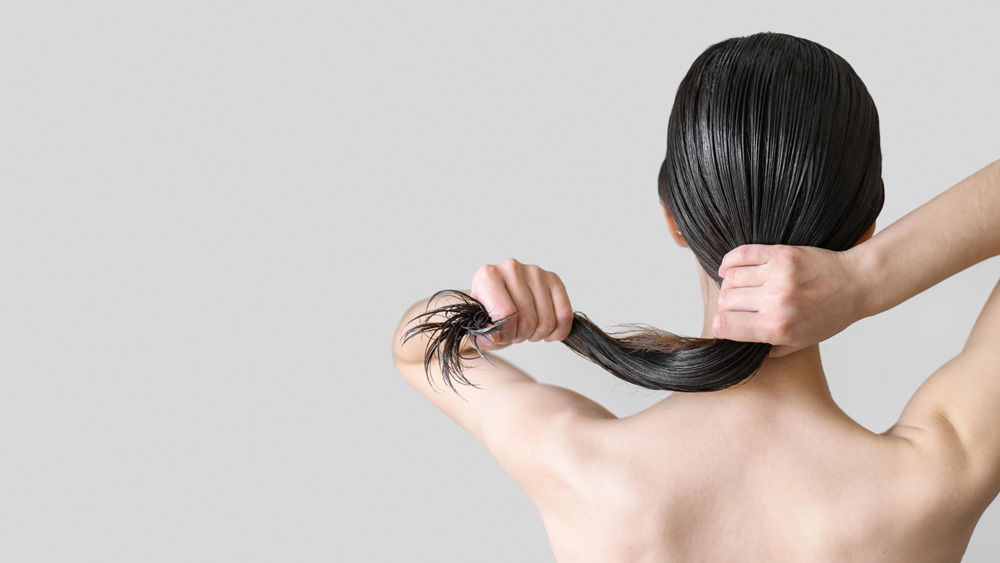alopecia