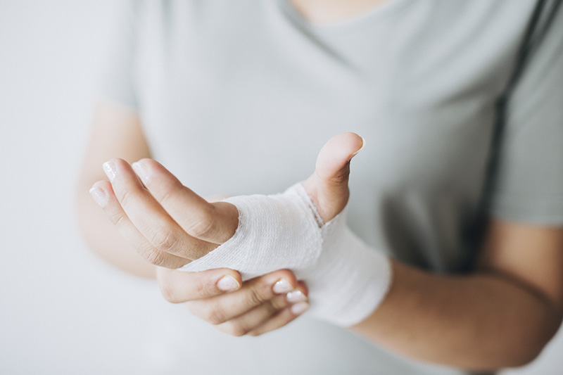 quemadura en la mano con venda