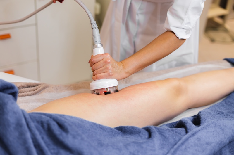 Radiofrecuencia en fisioterapia