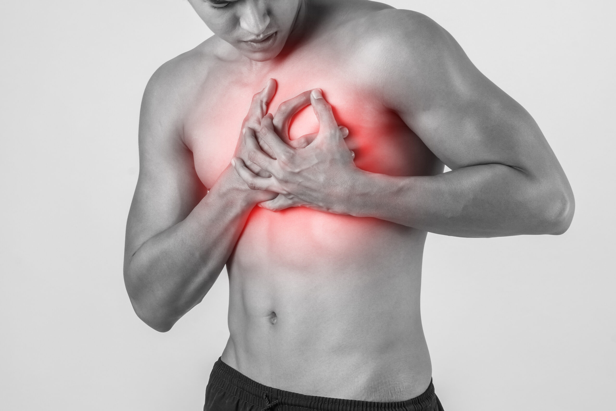 pericarditis