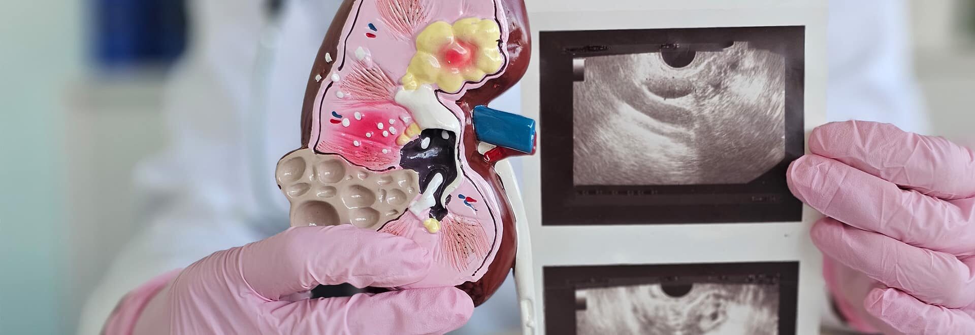 Urología en la Eliana