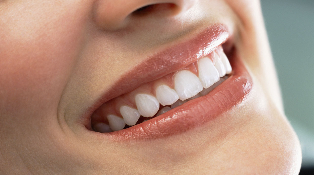 caries