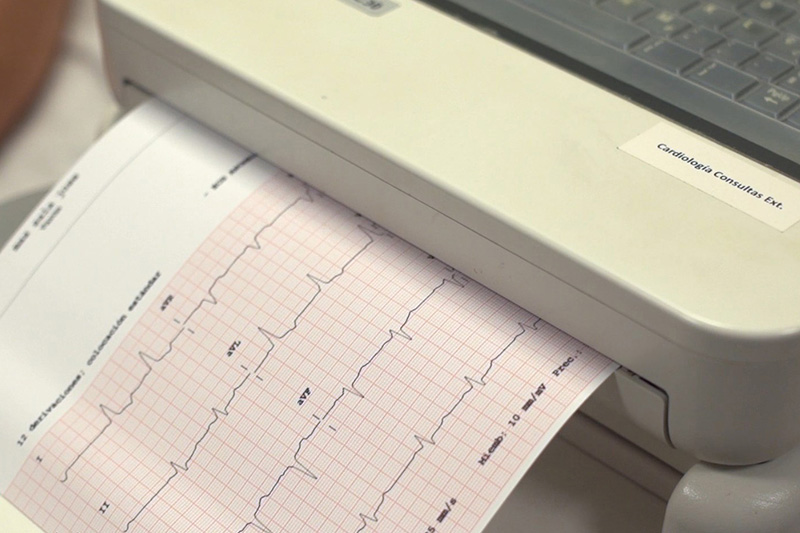 cardiovascular