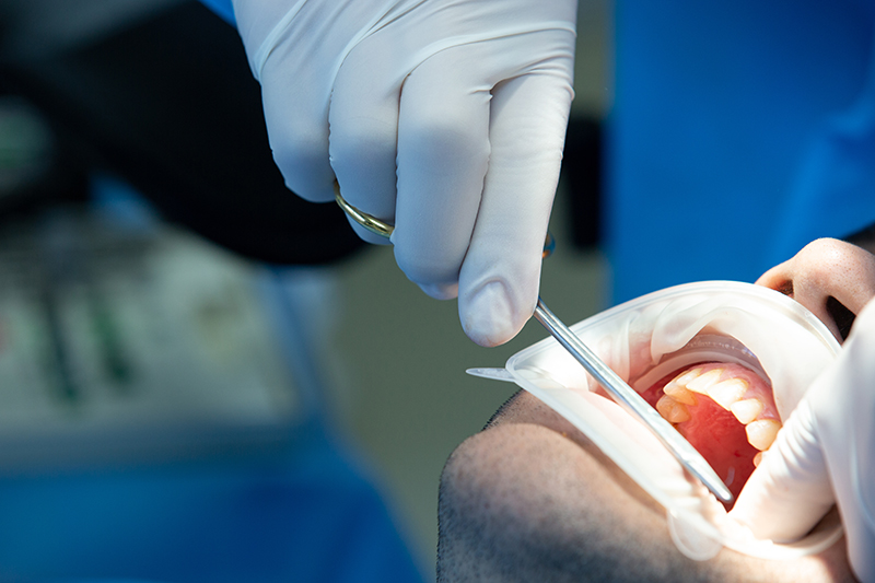 Servicio Cirugía oral maxilofacial Hospital Ribera Povsa