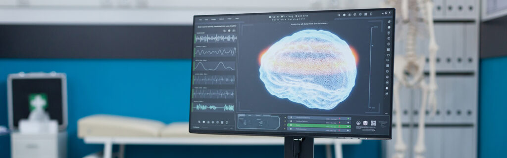 servicio de Neurofisiología del Hospital Ribera Povisa