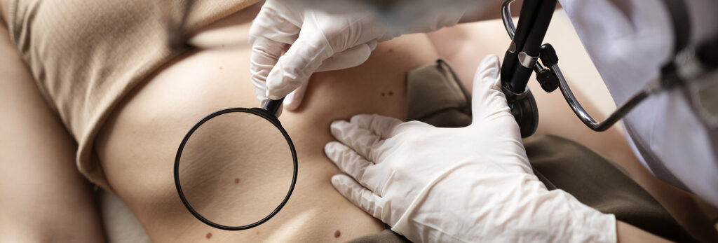 dermatología