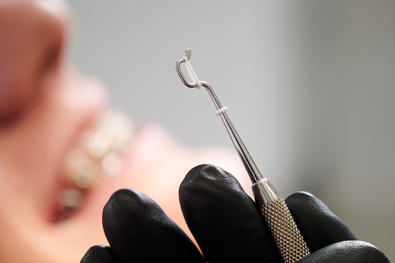 white rubber band for braces on steel dental tool macro snapshot