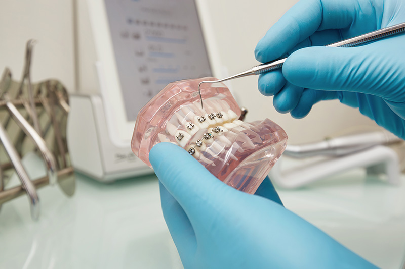 dentista modelo plastico dental tirantes