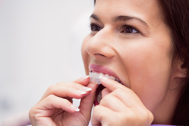 Female patient wearing braces in dental clinic