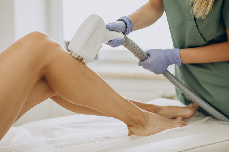 laser epilation hair removal therapy