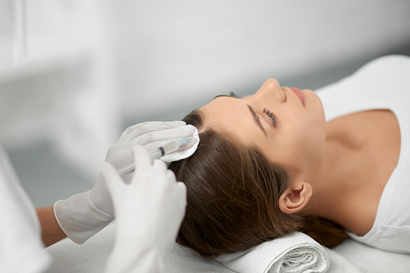 mesoterapia capilar