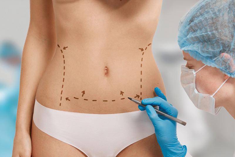 tratamiento para quitar la grasa abdominal