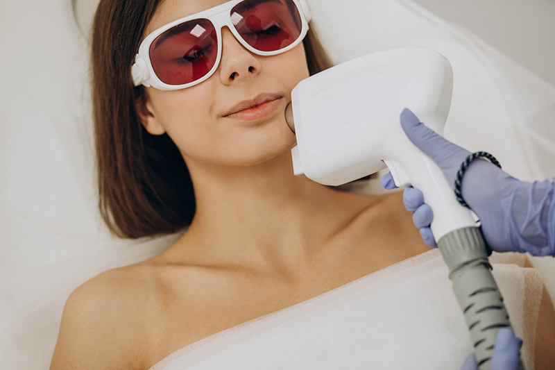 tratamiento de IPL en ribera estética