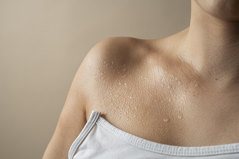 Hiperhidrosis o sudoración excesiva