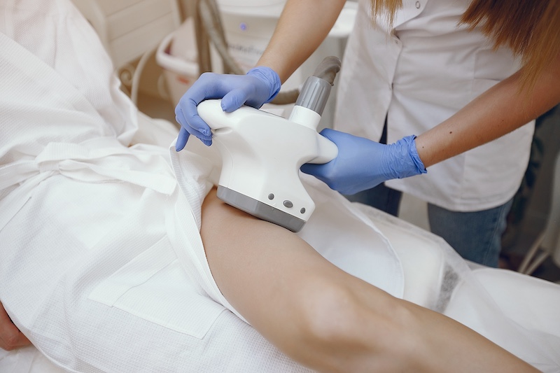 persona haciendose tratamiento de velashape