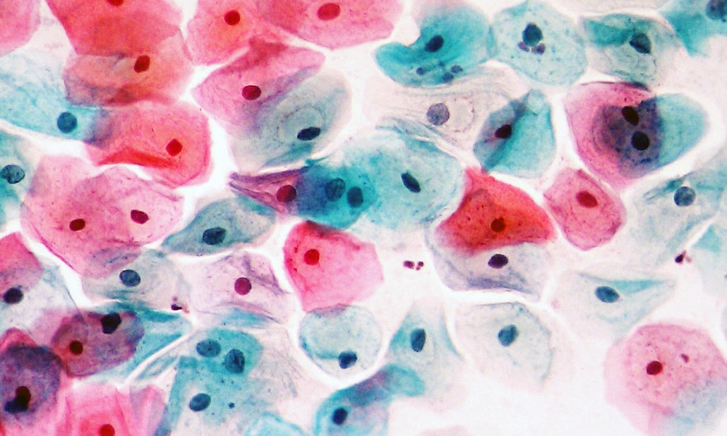 Citología cervicovaginal y biopsias Ribera Lab Citología cervicovaginal y biopsias Ribera Lab