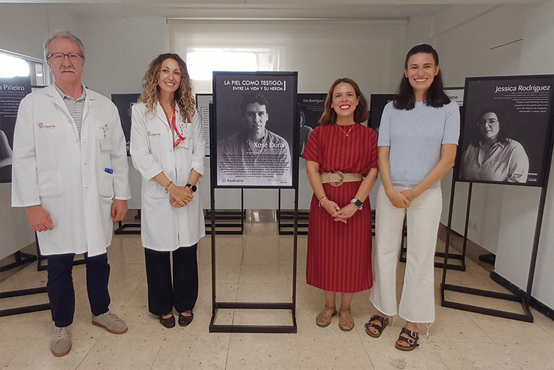 Ribera Juan Cardona acoge la muestra itinerante de Asotrame, “La piel como testigo: entre la vida y su herida”