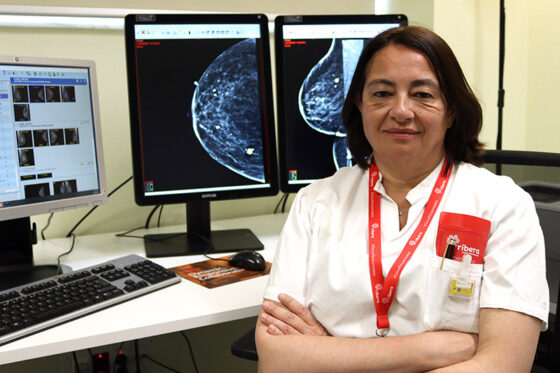 El Área de la Mama de Ribera facilita la mamografía 3D con contraste a mujeres con un cáncer previo o antecedentes familiares