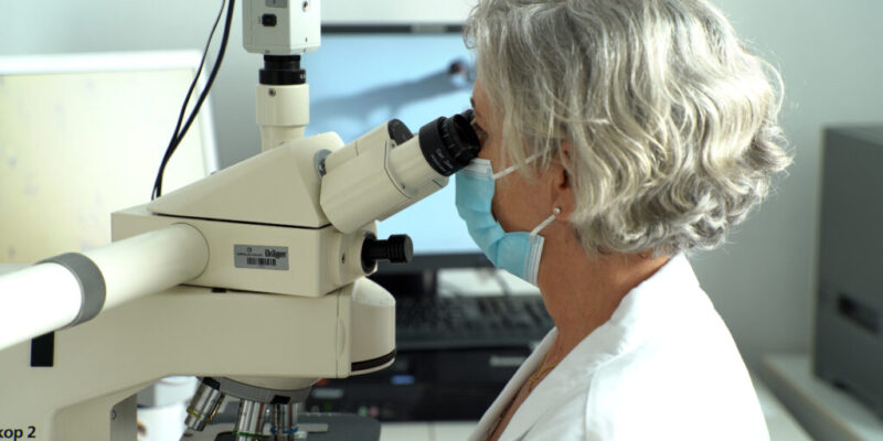 El Área de la Mama de Ribera revoluciona el diagnóstico del cáncer de mama y hace la firma genética en la biopsia inicial