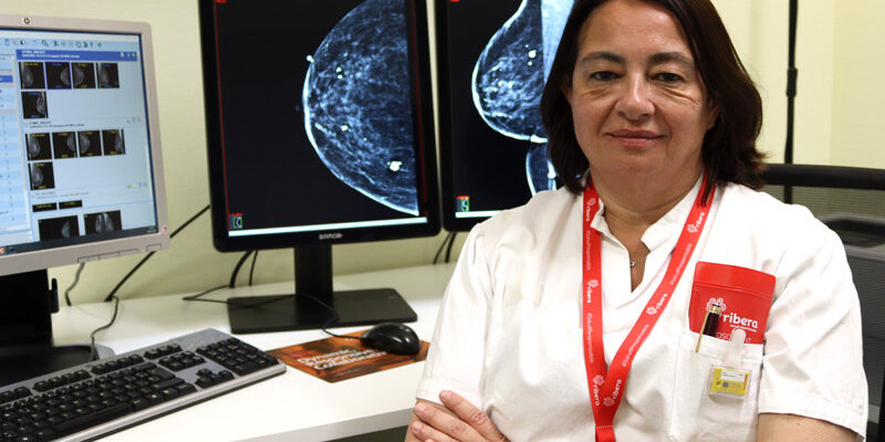 La mayoría de los ponentes del Curso de Mamografía con contraste de SEDIM son radiólogos del grupo Ribera
