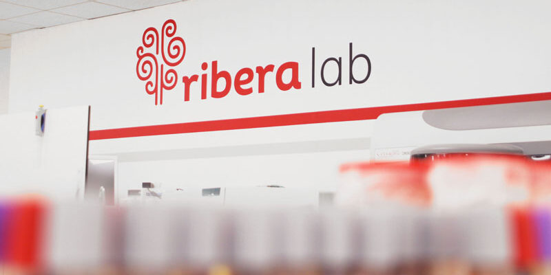 Ribera Lab mide la respuesta celular inmune al Covid con un nuevo test para conocer efectos de la vacuna o la infección