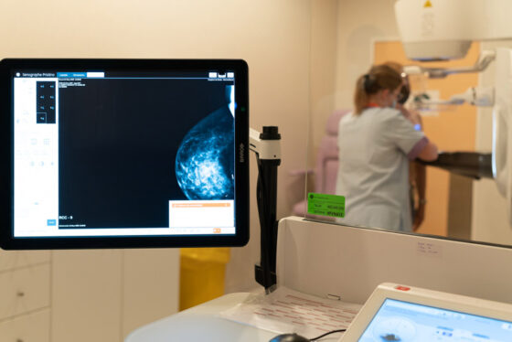 El Hospital de Dénia dispone de un nuevo mamógrafo con tecnología 3D