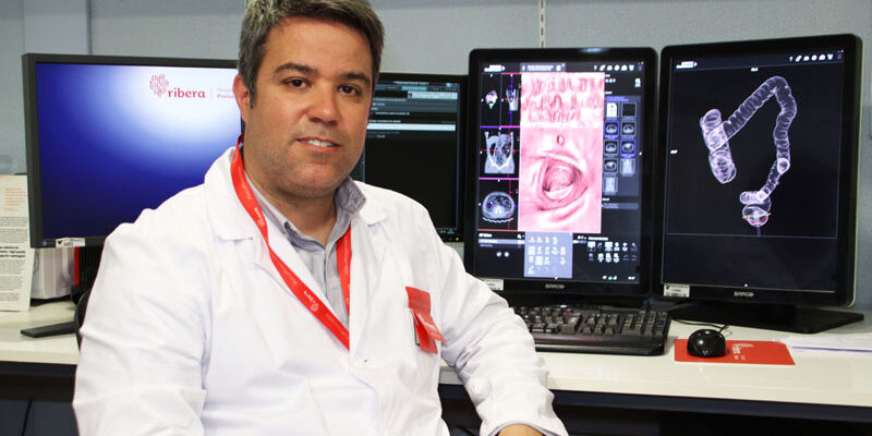 El Anillo Radiológico de Ribera integra ocho hospitales del grupo con los mejores especialistas por órgano sistema